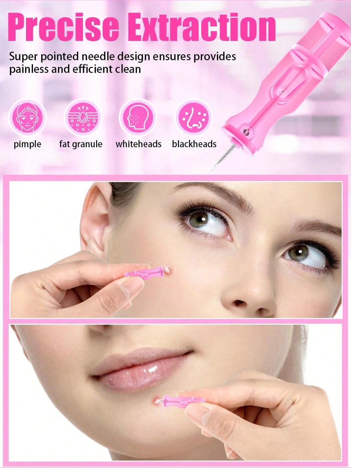 10/50/100/200pcs Disposable Acne Pimple Needles, Effective Blemish And Blackhead Removal Tool, Suitable For All Skin Types, Facial Skin Care Cleaning Tool For Salon And Home Use