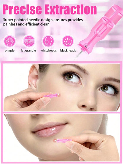 10/50/100/200pcs Disposable Acne Pimple Needles, Effective Blemish And Blackhead Removal Tool, Suitable For All Skin Types, Facial Skin Care Cleaning Tool For Salon And Home Use