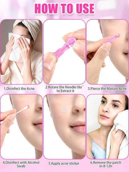 10/50/100/200pcs Disposable Acne Pimple Needles, Effective Blemish And Blackhead Removal Tool, Suitable For All Skin Types, Facial Skin Care Cleaning Tool For Salon And Home Use